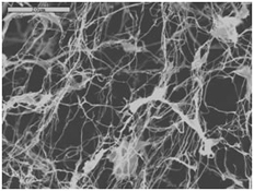 SEM Images of nanofibrille cellulose (NFC) hydrogel 